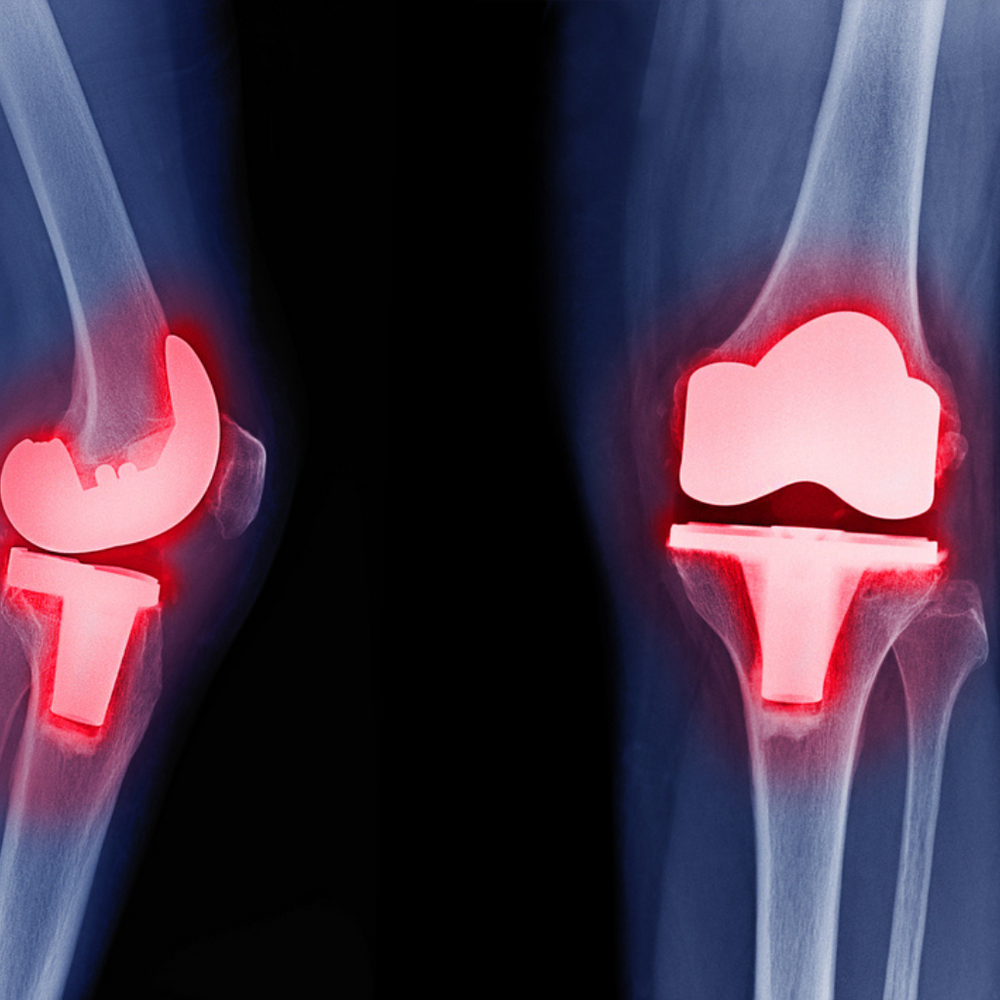 Medical Device Contamination Awareness - orthobond.com